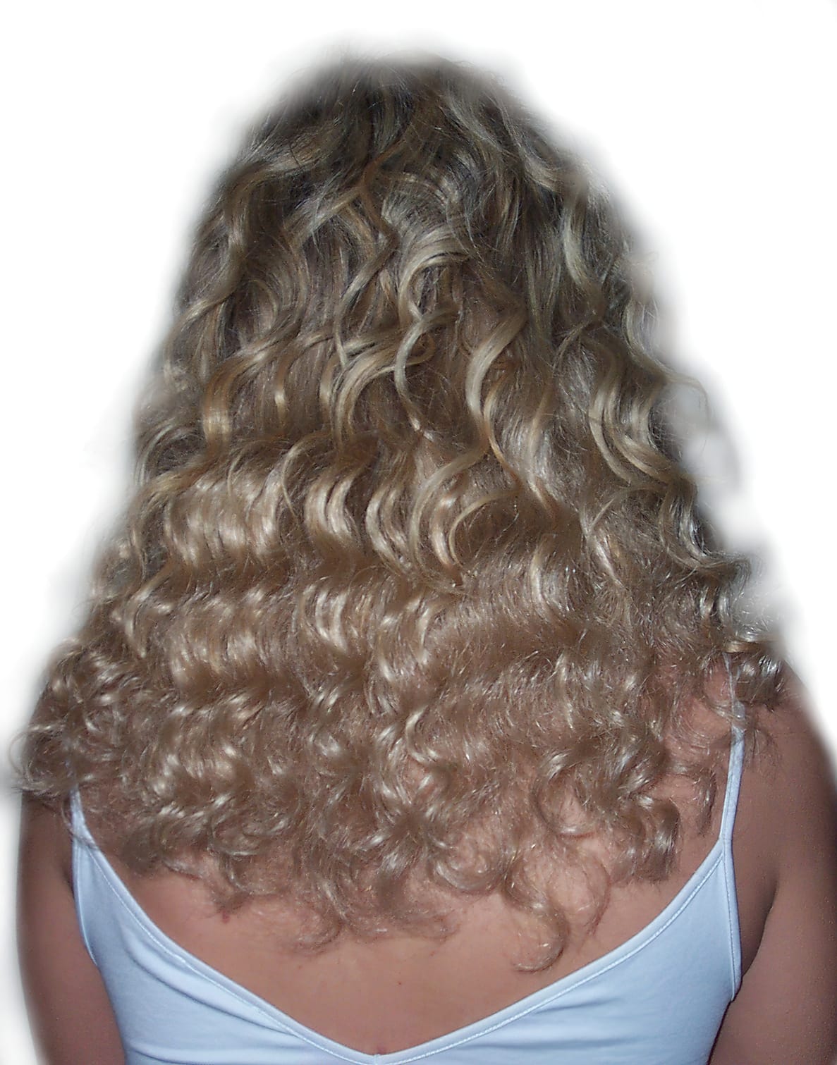 After Picture - Real Hair Extensions Bald Patches Recovery